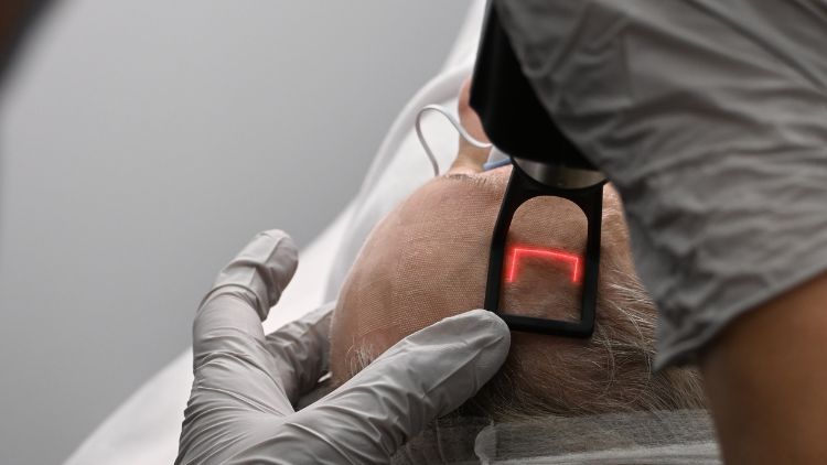 co2-laser-resurfacing-cost