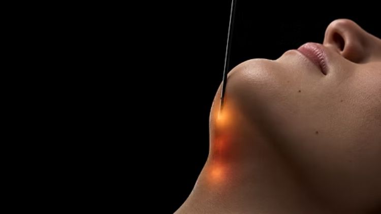 What Is QuantumRF? How the Procedure Works and What Recovery Can Involve
