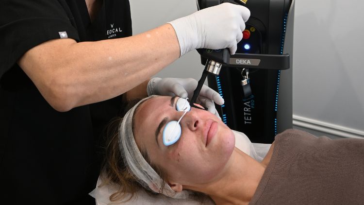 CO2 Laser for Wrinkles: Which Lines May Respond to Resurfacing?