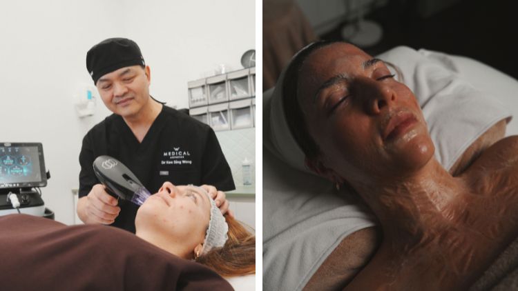 Morpheus8 vs HIFU: Understanding Which Skin Tightening Treatment Suits You