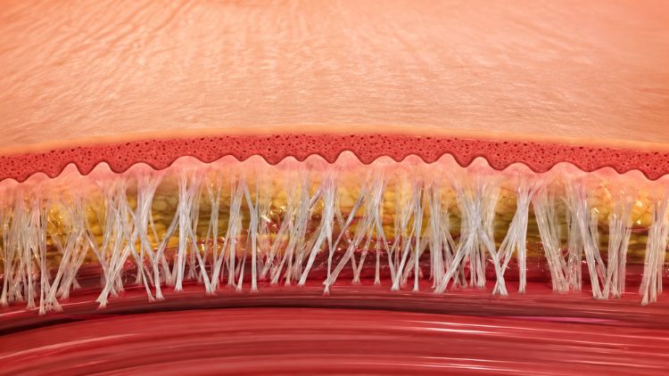 Illustration of skin and subcutaneous tissue, not a treatment outcome